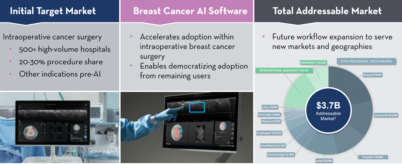 Perimeter Medical Imaging Ai, Inc.(xtsx:pink)